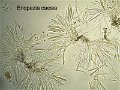 Eriopezia caesia-amf148.jpg-micro